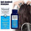 25-26 Nizoral Shampoo for Dandruff Control 7 fl oz 200ml EXP 4
