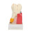 Professional Dental Aid, Movable Teeth Model for Advanced Periodontal Disease Teaching 1