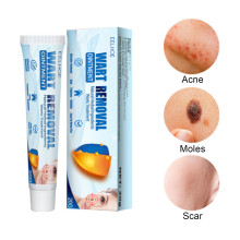 Versatile Wart Removal Cream Fast Acting Formula Works On Multiple Wart Types Safe For All Skin Types Suitable For Home Use