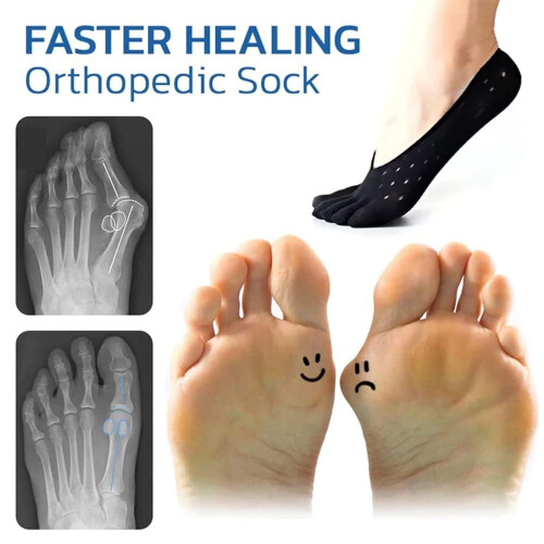 Κάλτσες Orthoes για ανακούφιση από κότσια για γυναίκες – 5 ζευγάρια ορθοπεδικές 1