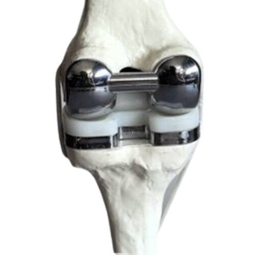 Knee Joint Model Simulation Replacement Surgery Meniscus Ligament Cartilages Surgery Model,Artificial Knee Joint 2