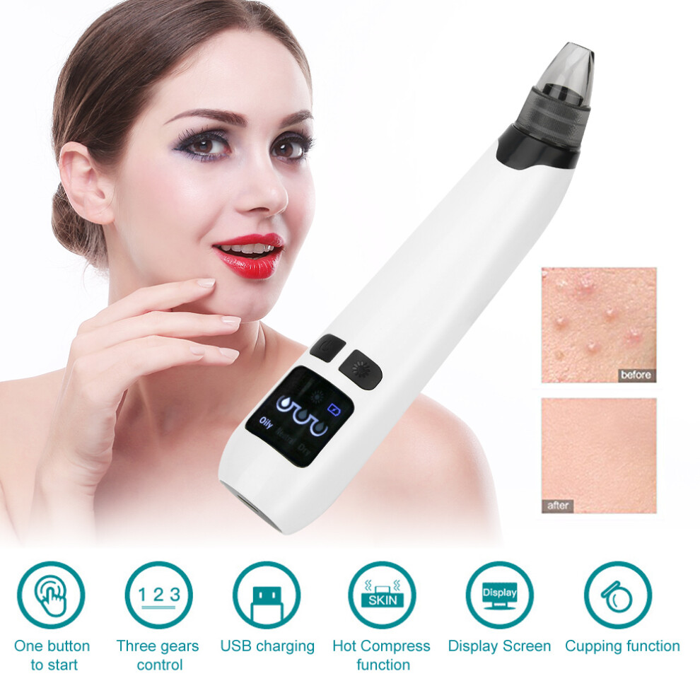 White Handheld Blackheads Removal Machine, Abs, 17.2Cm