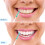 Triani Interdental Brushes Soft Silicone 150Pcs 6