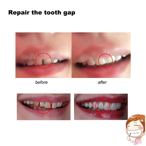 Teeth Fangs Dentures Props Halloween Temporary Tooth Kit 4mm