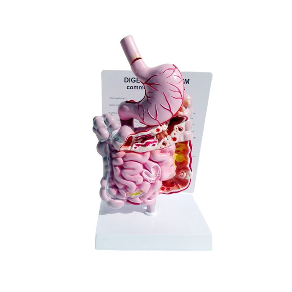 Tlily Human Digestive System Model Stomach Anatomy Intestine Cecum Rectum Duodenum Human Internal Organs Structure Model