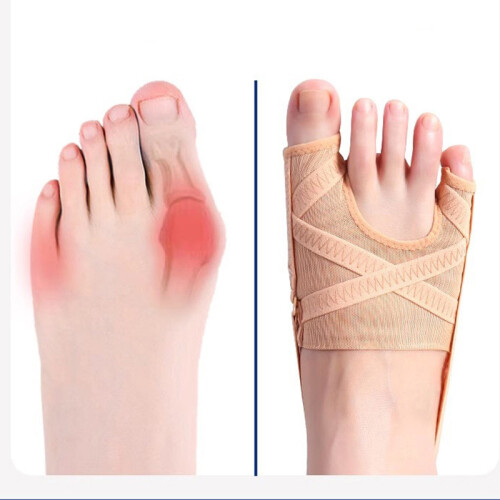 Breathable Double Toe Corrector for Bunion and Overlapping Toes  M 2