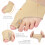 13pcs Bunion Relief Kit with Toe Separators & Spacers, One Size 1