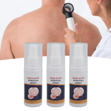 3 Stück 60ml Rückenschmerz-Spray gegen Pickel, Ölregulierung & Glättung