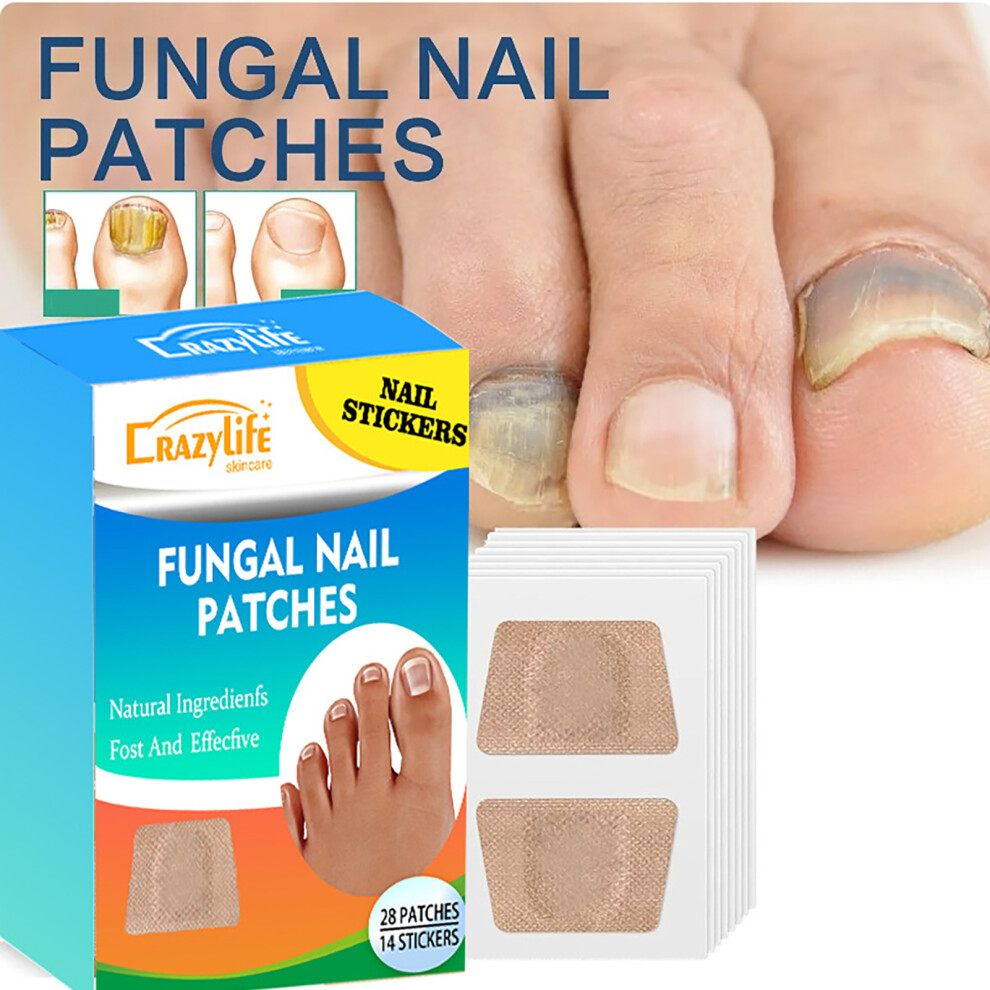 Dachuang Beauty Ingrown Toenail Corrector Patches - Breathable, Elastic
