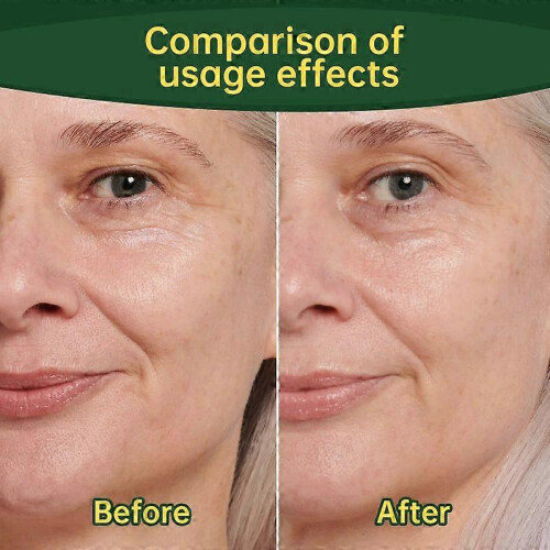 Stem Cell Collagen Peptide Oral Drops Sagging Skin Reduce Wrinkle 2