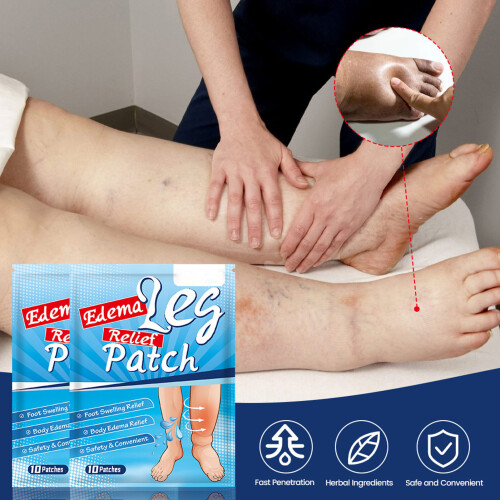 Leg Edema Relief Patch 50pcs Herbal Extract 2