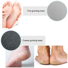 Electric Foot Callus Remover Vacuum Pedicure Tool White Blue Battery Powered