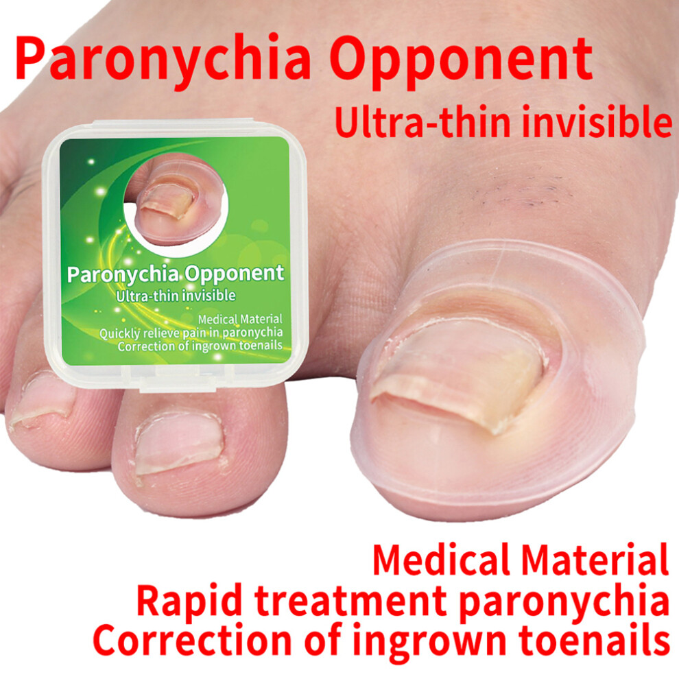 2pcs Silicone Ingrown Toenail Corrector Pain Relief Paronychia Treatment