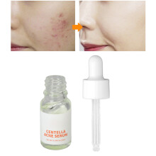 Siero Rimuovi-Biglia Gotu Kola 10ml, Riparazione della Pelle, Texture Leggera Acquosa