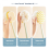 (Green) Exfoliating Back Scrubber Brush, 100% New Loofah Bath Sponge Set 4