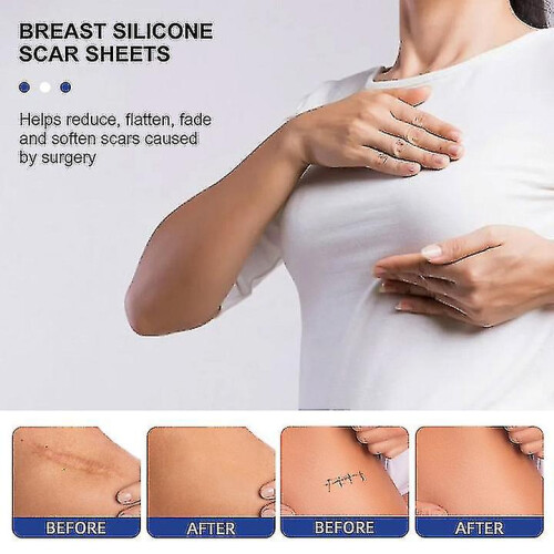 Silicone Sheets Silicone Sheets for 8 Pack Reduction for Scars, Removal Sheets, 4 Areola Soft Strips 4 An 2