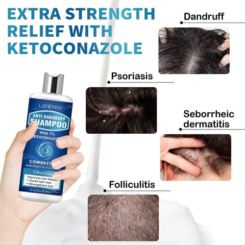 (5PCS)1-5x Anti-Dandruff Shampoo with 1% Ketoconazole, Fresh Scent,300ml 2