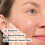 The Ordinary The Ordinary 100% Organic Cold-Pressed Rose 4