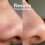 SKIN CHOICE Pore Strips - Breakout 5