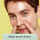 SKIN CHOICE Pore Strips - Breakout 8