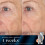 Medik8 Medik8 Retinal Rewind - Age-Defying Face 3