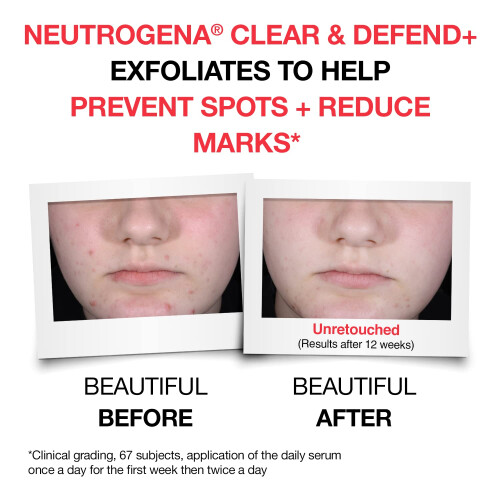 Neutrogena Neutrogena Clear and Defend+ Serum 30ml 2