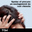 Neutrogena Neutrogena T/Gel Strong Severe Itchiness 250ml 3