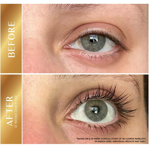 Eyelash Growth Serum 5 mL: Get 2