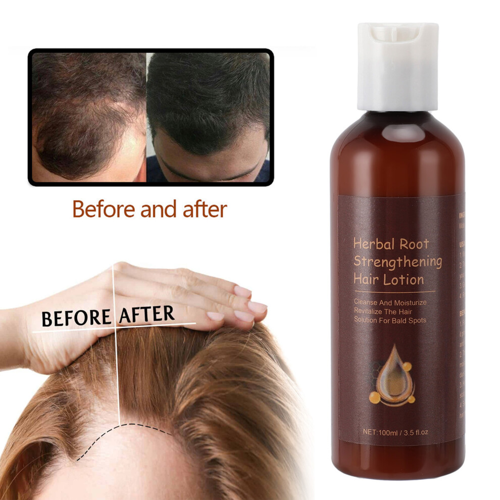 3PCS 100ml Hair Root Thickening Lotion Nourishing Moisturizing Herbal Care