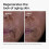 The Ordinary The Ordinary GF 15% Solution, Anti-Aging 4
