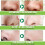 Blackhead Remover Strips, 10 PCS Individually 2