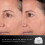 Medik8 Medik8 Advanced Pro-Collagen+ Peptide Cream Refill 6