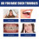 Jaw Adjustment Clamp, Solution To Tooth Andjaw Alignment Issues 5