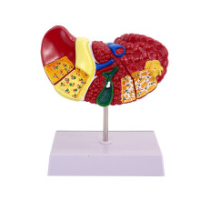 Liver Model for Common Pathologies, Liver Model Human Anatomy Doctor Office Anatomy Model