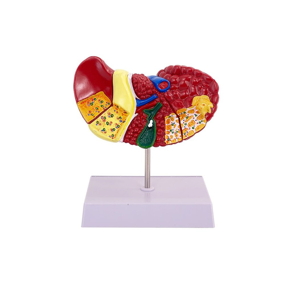 Liver Model for Common Pathologies, Liver Model Human Anatomy Doctor Office Anatomy Model