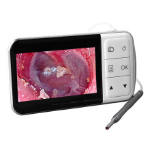 Digital Ear Camera Otoscope with 4.5" Screen, 1920x1080 Res