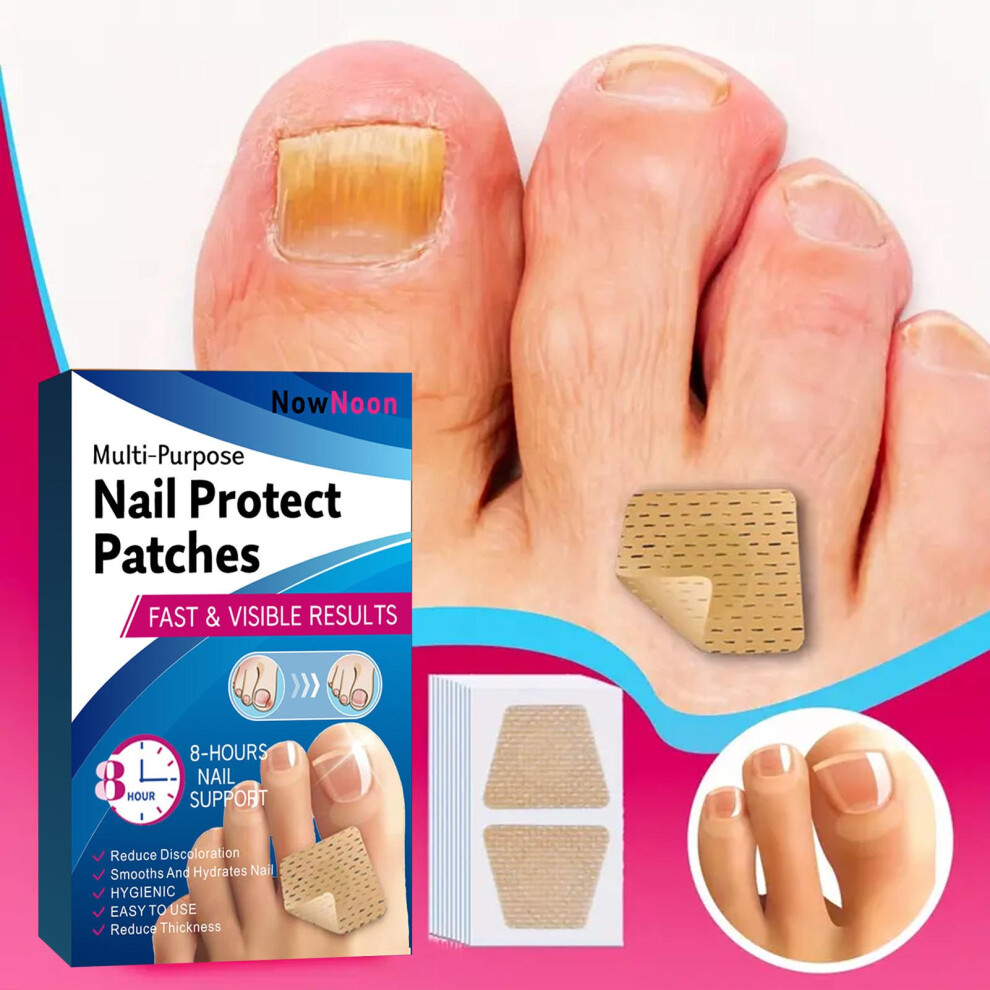 Zhouq-Outdoors 72Pcs Nail Repair Patches For Damaged & Discolored Nails