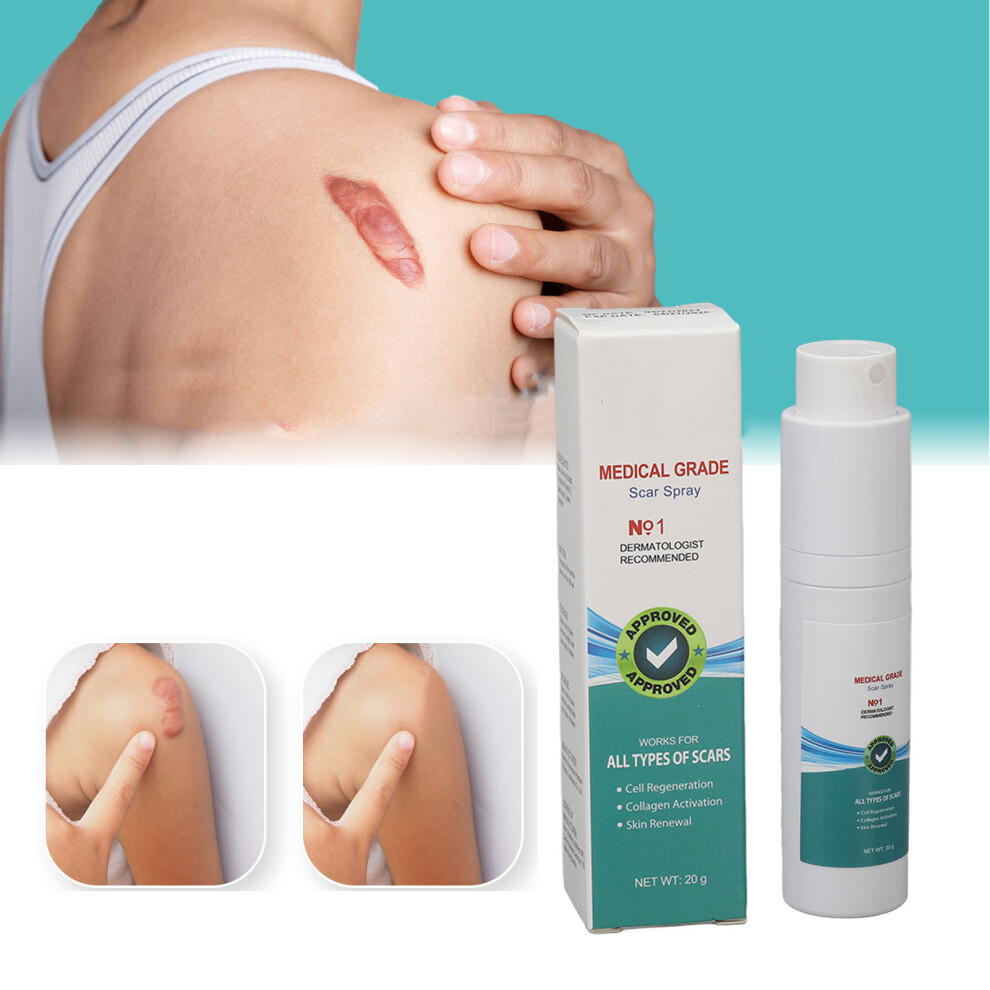 2pcs Stretch Mark & Scar Care Spray 20g Organic Skin Remedy