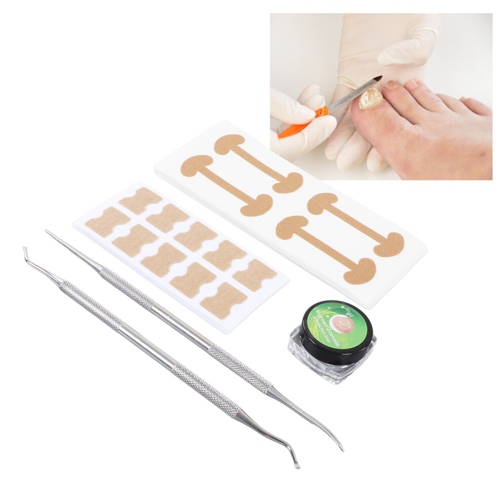 Ingrown Toenail Treatment Kit Toenail Correction Patch C Type Strips Tool Kits
