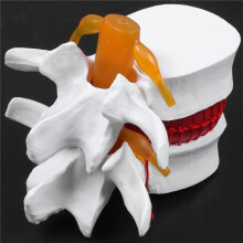 2X Menschliche Anatomie Skelett Wirbel Saeule Band Scheiben Vorfall Unterrichts Modell Gehirn Schaedel Traumatischer Schul Bedarf Medizinische