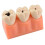 Dental Caries Teeth Model for Education, Realistic Removable Resin Teeth with Cavity Visualization 2