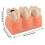 Dental Caries Teeth Model for Education, Realistic Removable Resin Teeth with Cavity Visualization 5