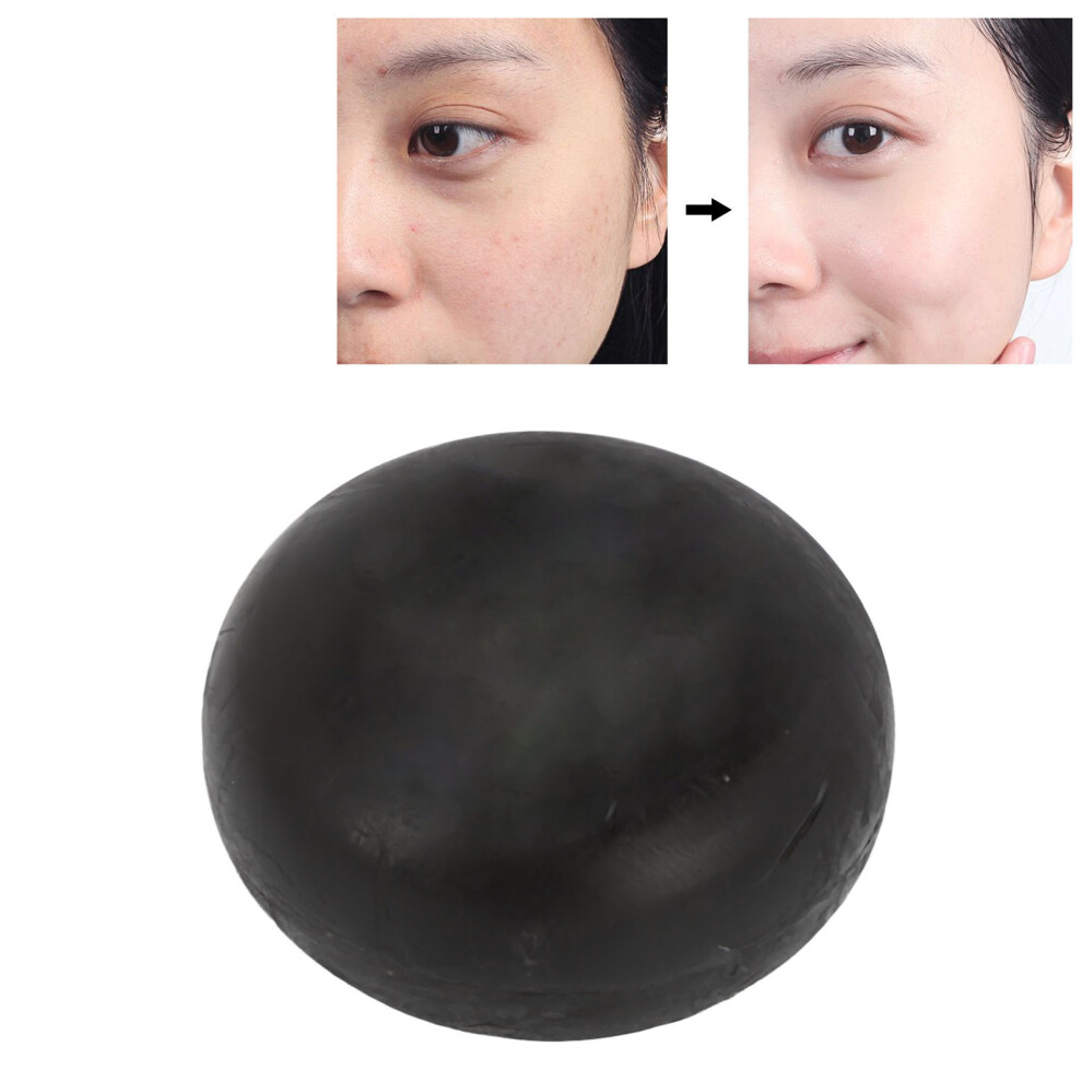 Salicylic Acid Soap Bar Oil Control Blemish Pimple Remover