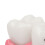 Dental Caries Model Tooth 6X Decay Demonstration for Teaching Labs 4