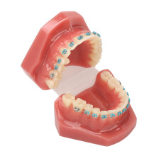 Orthodontic Model with 28 Teeth & Metal Brackets for Dental Education\