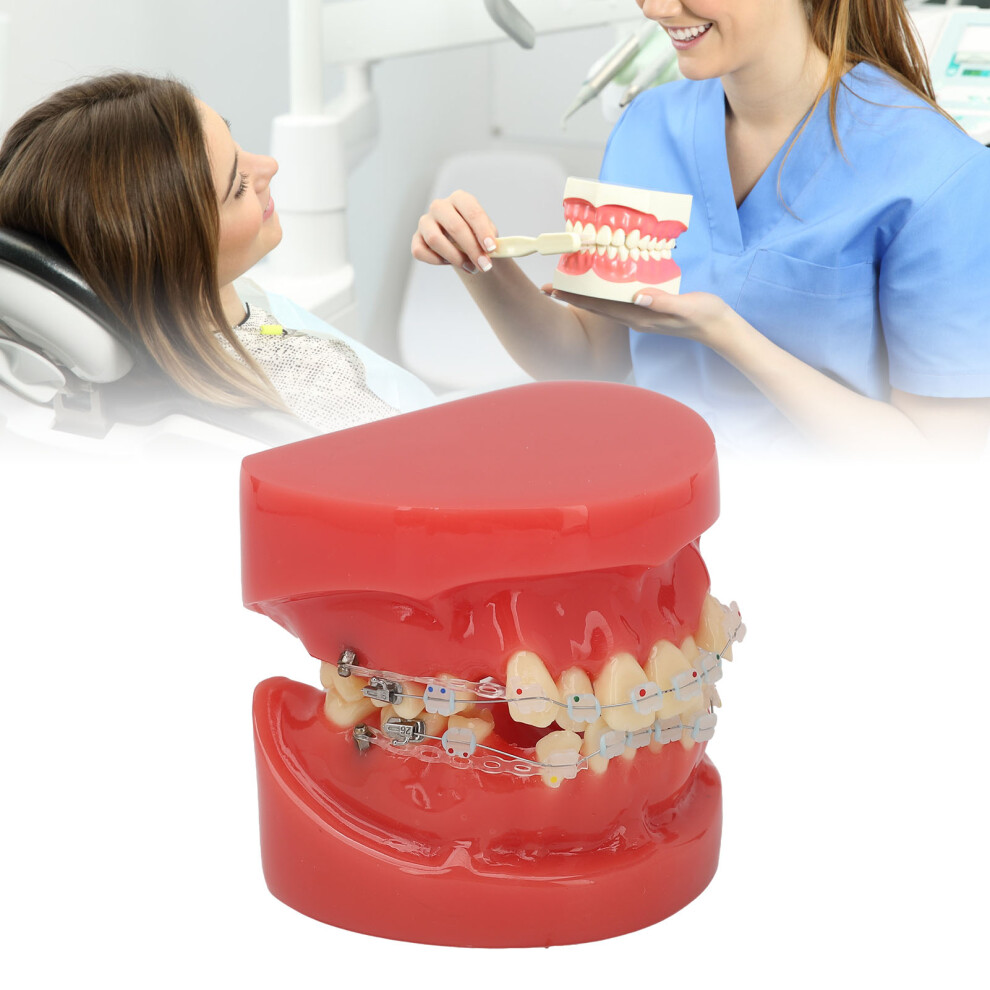 Ceramic Dental Orthodontic Model 24 Teeth with Wires & Brackets