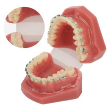 Dental Orthodontic Demonstration Model Resin & Metal with Brackets for Teaching
