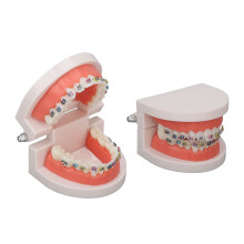 Zahnmodell mit orthodontischen Metallbrackets für Zahnlabor und Ausbildung