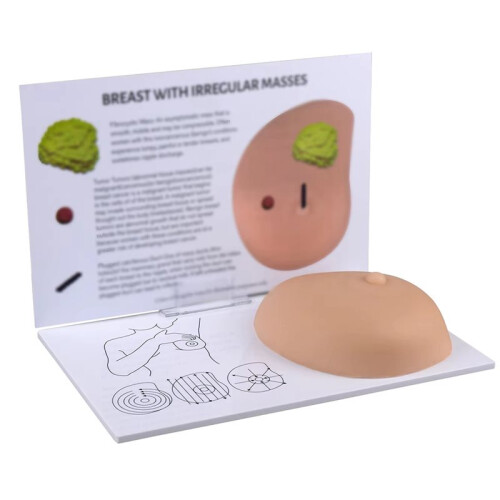 Teaching Breast Human Pathological Anatomy Breast Self Exam Model Irregular Masses Pathological Examination Model 1