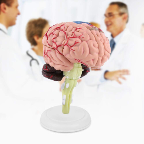 Human Brain Anatomy Model with Removable Sections for Medical Study and Classroom Teaching 1